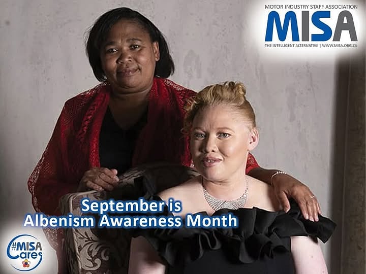 Albinism: A parent’s perspective